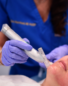 microneedling in beverly hils