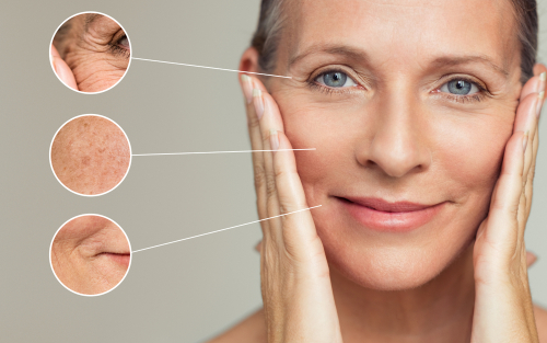 estrogen skin, perimenopause skin, estrogen skin, perimenopause skin, skin aging hormones