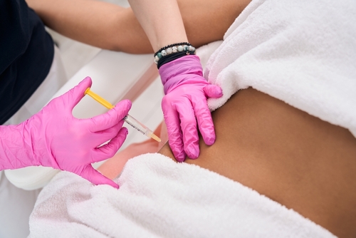 skin laxity treatment